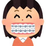 【矯正相談】歯を抜いた隙間はどれぐらいで閉じる？